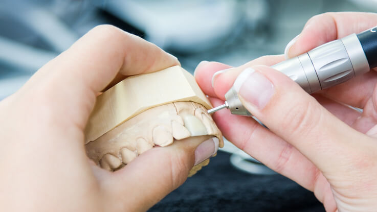 denture-repair