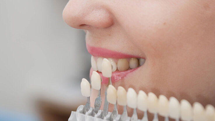 restorative-dentistry